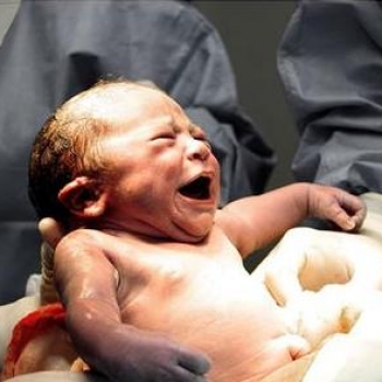 ¿Cuántos niños nacen por cesárea al año en Costa Rica? 